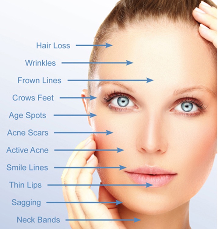 Skin needling
