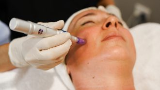 Skin Needling