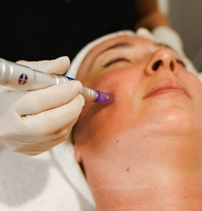 Skin Needling